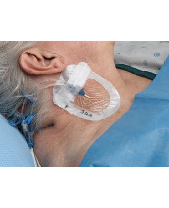 TEGADERM 3M I.V. ADVANCED 8,5x11,5 cm per linee centrali