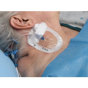 TEGADERM 3M I.V. ADVANCED 8,5x11,5 cm per linee centrali