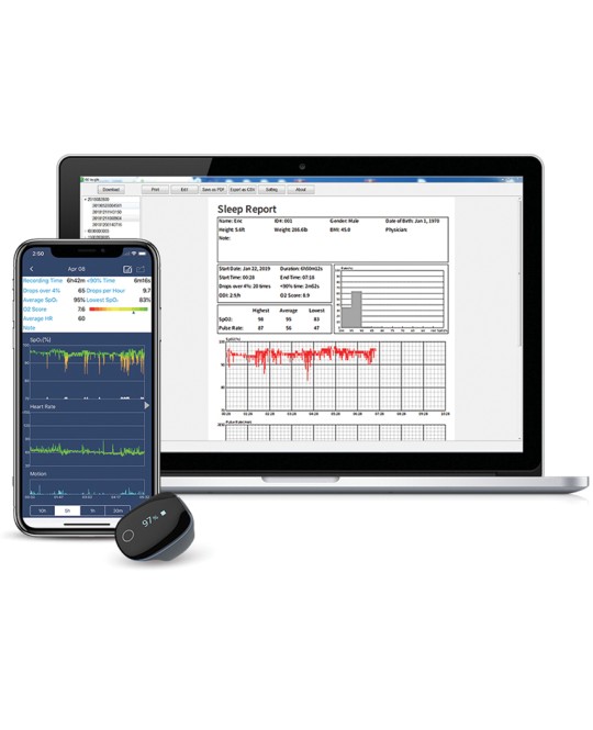 PULSOXIMETRO O2RING MONITORAGGIO CONTINUO - adulti