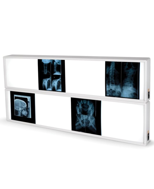 NEGATIVOSCOPIO 2x4 PANNELLI 76 x 153 cm