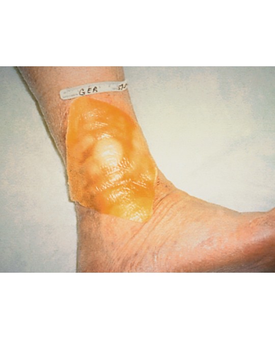 TEGADERM 3M IDROCOLLOID 10x10 cm - quadrato