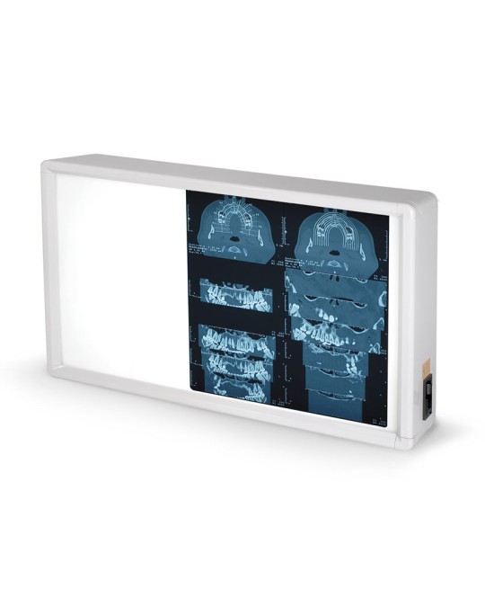 NEGATIVOSCOPIO 38x62 cm