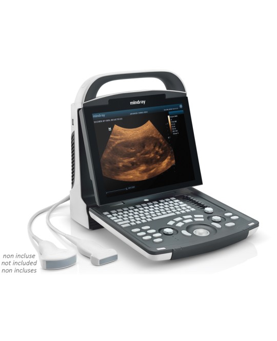 NUOVO ECOGRAFO MINDRAY DP-20