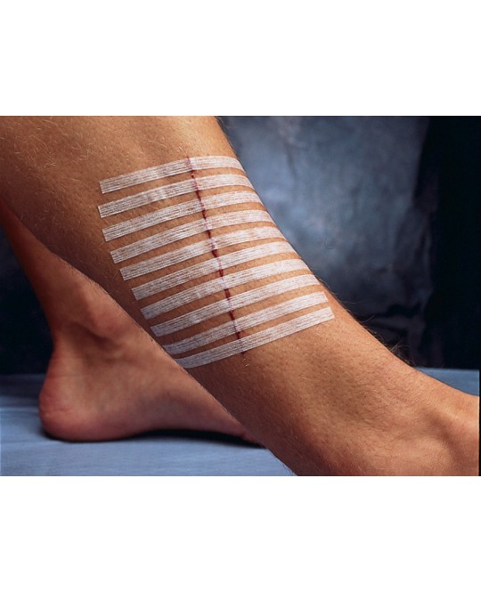STERI-STRIP 3M - 100 x 6 mm