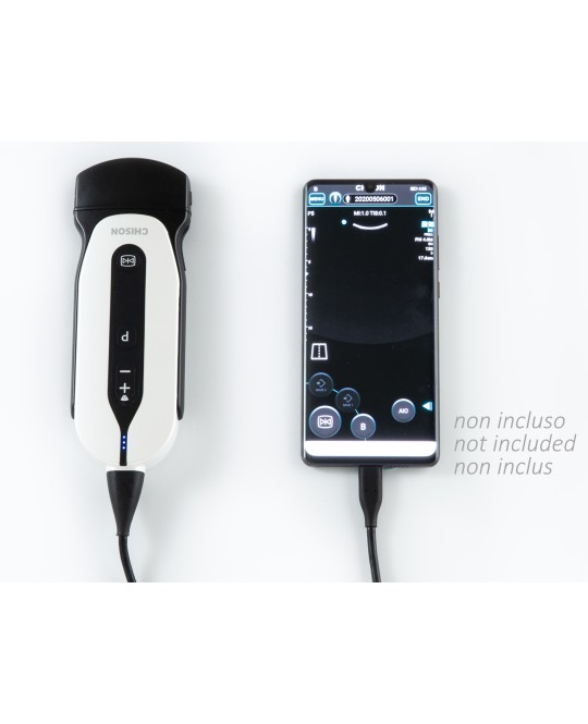 SONOEYE P5 DOPPLER DIGITALE A COLORI - Sonda Convex