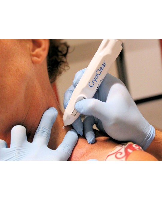 DISPOSITIVO CRIOCHIRURGICO CRYOCLEAR con cartuccia 16 g