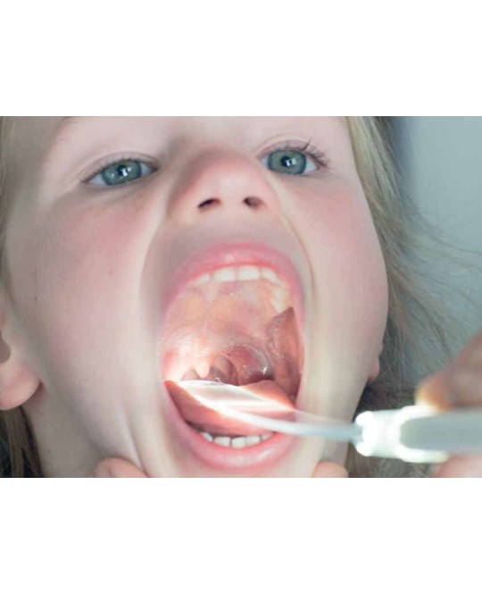 KIT THROAT SCOPE - abbassalingua luminoso (1 manico + 50 lame) -blister