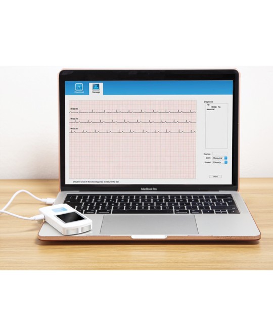 ECG PALMARE PM-10 Bluetooth