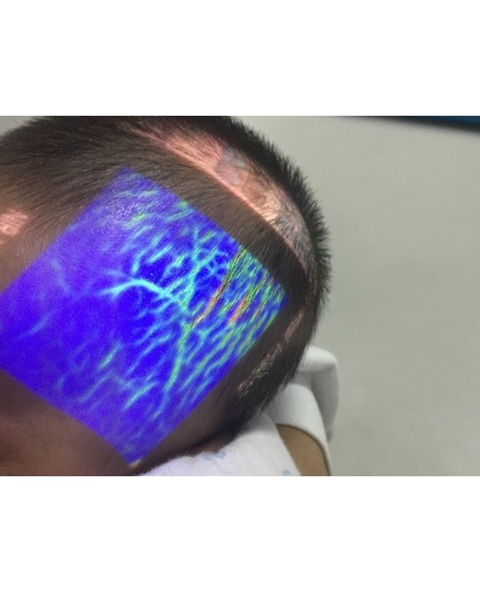 SISTEMA VEIN SHOW PROFESSIONALE