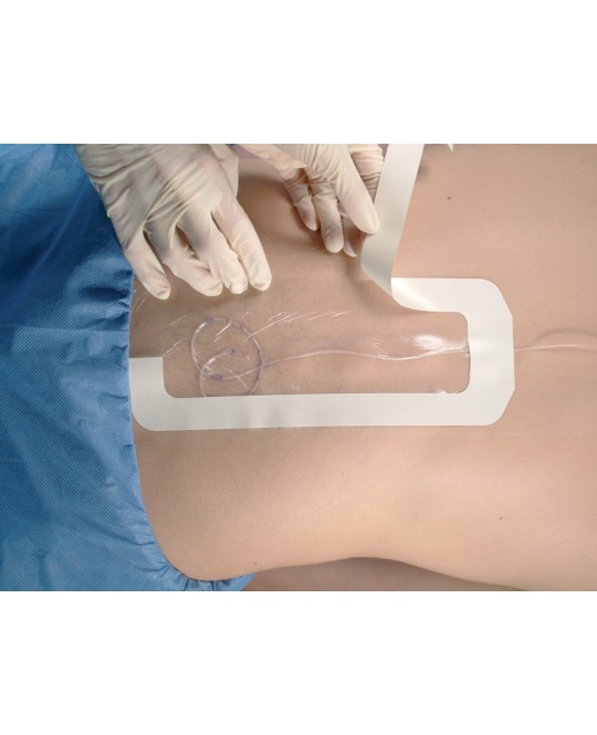 TEGADERM 3M - 10 x 25 cm - sterile