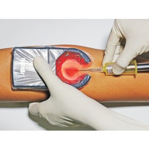 VEINSPY RILEVATORE VENE PORTATILE