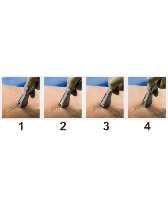 SUTURATRICE CUTANEA DI PRECISE 3M - 15 punti - sterile