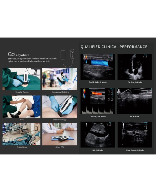 SONOEYE P2 DOPPLER DIGITALE A COLORI - Sonda Linear Array