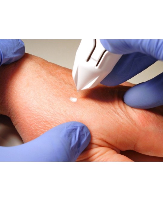DISPOSITIVO CRIOCHIRURGICO CRYOCLEAR con cartuccia 16 g