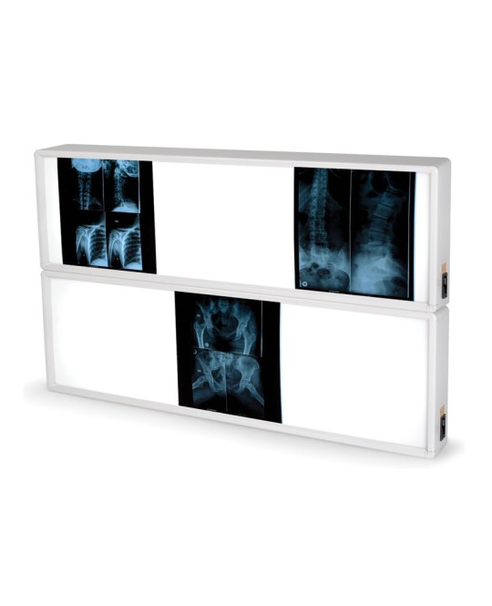 NEGATIVOSCOPIO 2x3 PANNELLI 76 x 122 cm