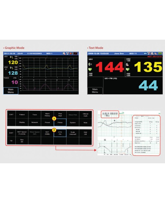 MONITOR FETALE FC1400