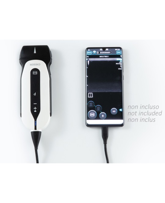 SONOEYE P2 DOPPLER DIGITALE A COLORI - Sonda Linear Array