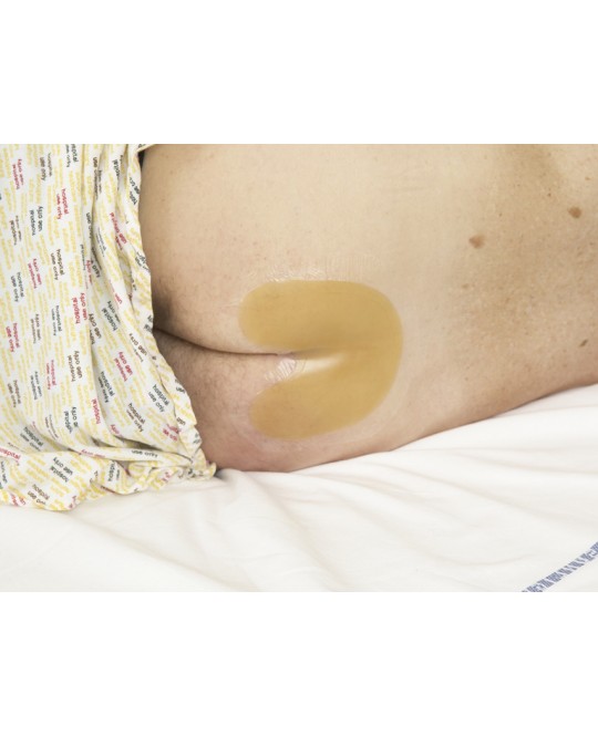 TEGADERM 3M IDROCOLLOID 16x17 cm - sacrale