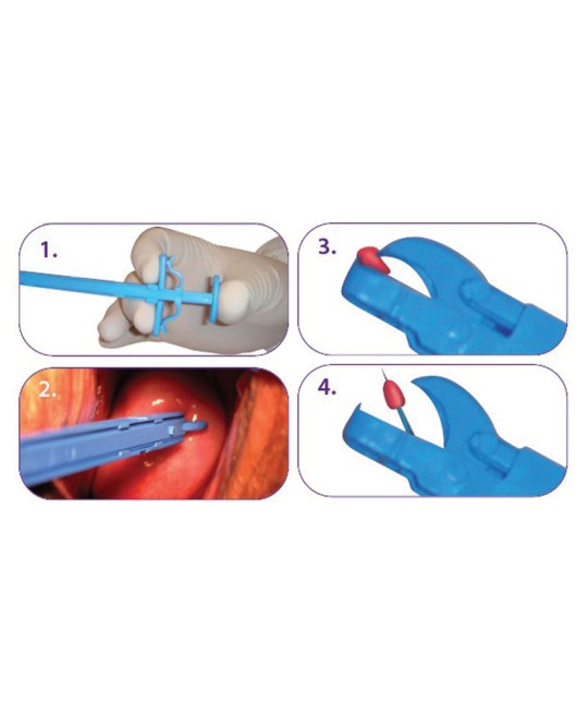 PINZA BIOPSIA GYN&PUSH 21,5 cm - sterile