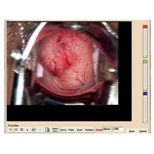 SOFTWARE per 29620, 29600 (con 29603)