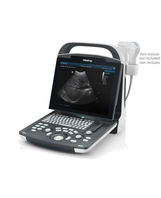 NUOVO ECOGRAFO MINDRAY DP-20