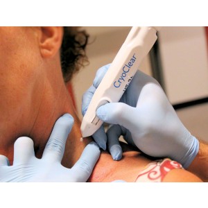 DISPOSITIVO CRIOCHIRURGICO CRYOCLEAR con cartuccia 16 g