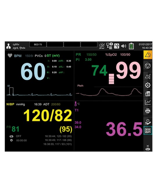 MONITOR GIMA BM3 PRO - SpO2+ECG+NIBP+TEMP+RESP
