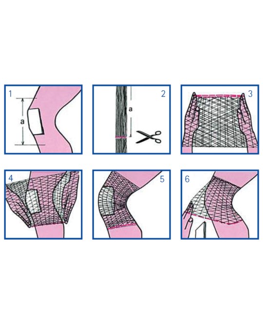 RETE TUBOLARE ELASTICA - calibro 5 per ginocchio e gamba