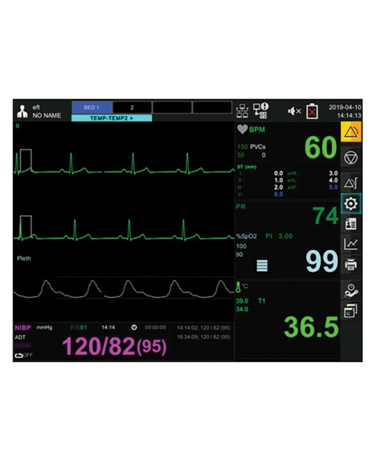 MONITOR GIMA BM3 PRO - SpO2+ECG+NIBP+TEMP+RESP