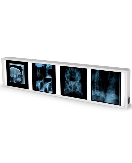 NEGATIVOSCOPIO QUADRUPLO 38 x 153 cm