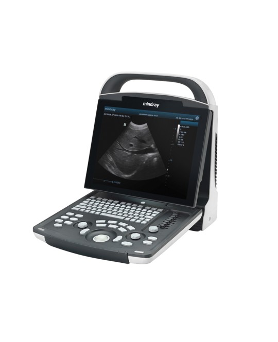NUOVO ECOGRAFO MINDRAY DP-20