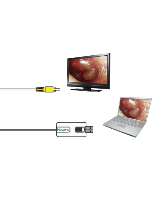 VIDEOTOSCOPIO MD SCOPE - completo di 2 sonde