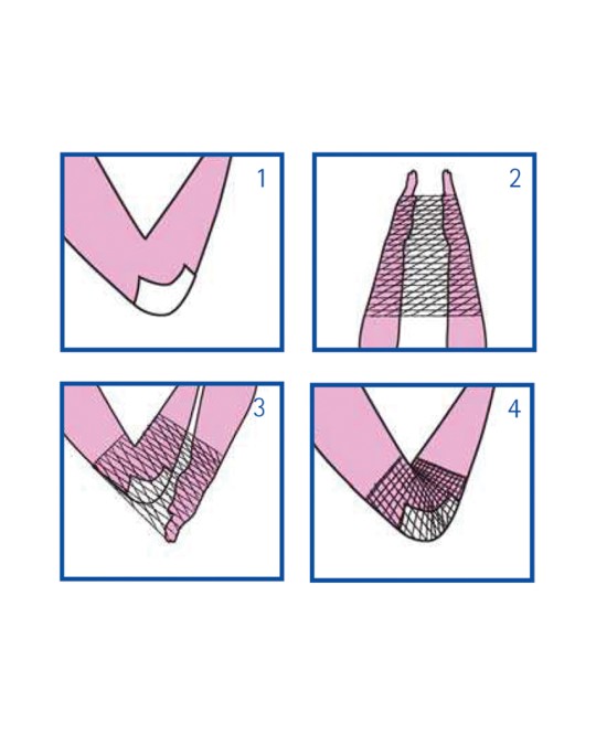 RETE TUBOLARE ELASTICA - calibro C per braccio e spalla - latex free