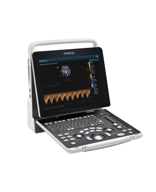 COLOR DOPPLER MINDRAY Z50 con 2 connettori sonda